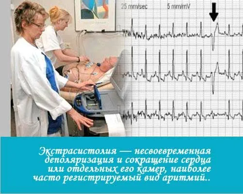 Як лікувати аритмію серця: ліки як лікувати аритмію серця