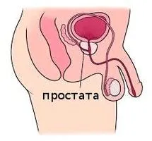 як лікувати рак 2 ступеня