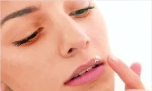 як лікувати заїди на губах