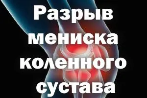 чи можна вилікувати меніск без операції