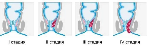 потрібно