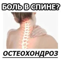 як лікувати невралгію після оперізуючого лишаю
