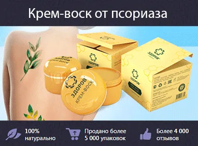 як лікувати підошовний псоріаз