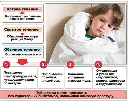 Ознаки туберкульозу у дітей як правильно лікувати туберкульоз у дітей