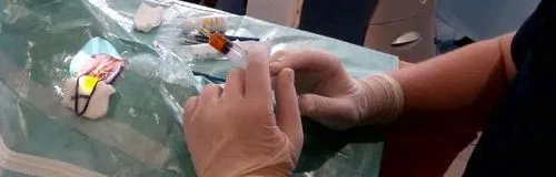 Короткозорість прогресуюча (міопія) у дітей і дорослих: небезпека... прийом офтальмолога