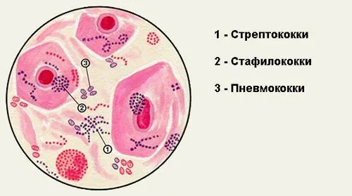 наривається ясна
