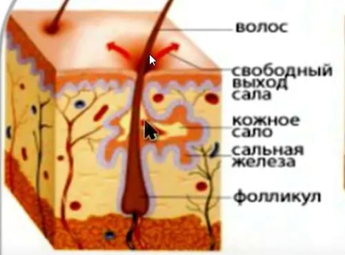 прищі на попі