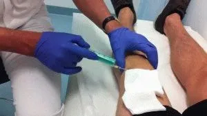 як вилікувати забій коліна
