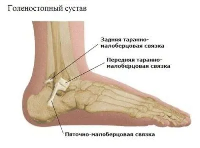 як лікувати розтягнення зв'язок спини