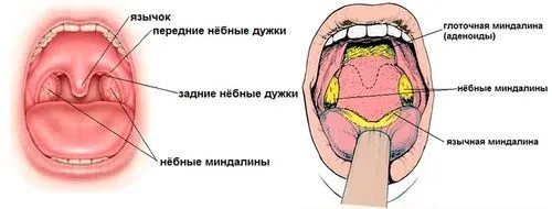 як лікувати хронічні гланди