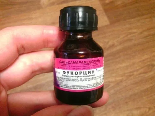 як вилікувати грибок нігтів будинку