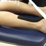 як лікувати розтягнення гомілки