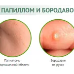 вилікувати алергію назавжди