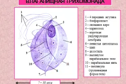 Чим лікувати трихомоніаз стоп ЗПСШ