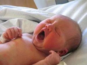 як лікувати алергію однорічній дитині