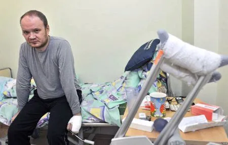 лікувати забій грудної клітини
