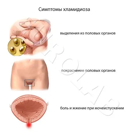 як лікувати хламідіоз