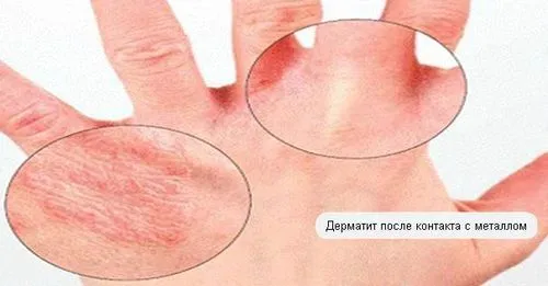 мазь