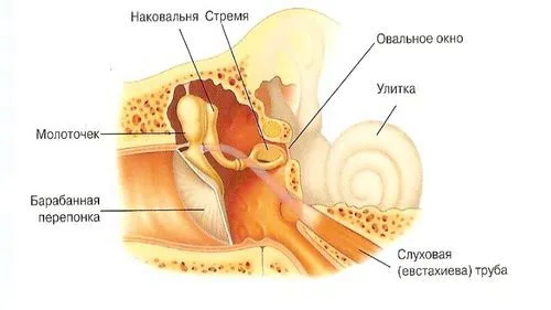 як лікувати отит носа