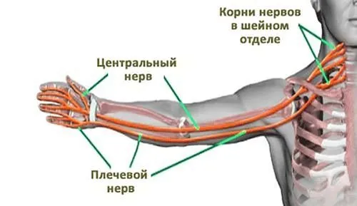 лікувати невралгію плечового нерва