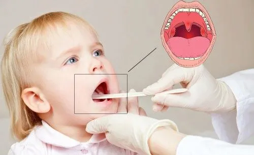 як лікувати дитячий ревматизм
