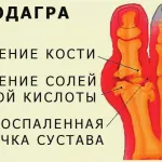 вірус