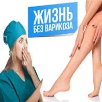 як лікувати варикоз в домашніх умовах