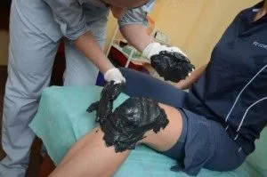 як лікувати суглоби брудом