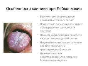 як лікувати лейкоплакію мови