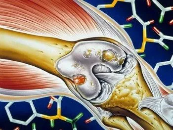 як лікувати ГРВІ при ревматоїдному артриті