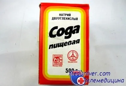 лікують молочницю содою