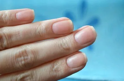 нігтьове ложе гиперкератоз відшарування пластина лікування ніготь після видалення
