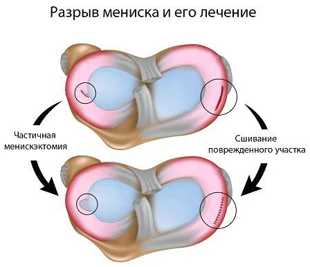 лікування