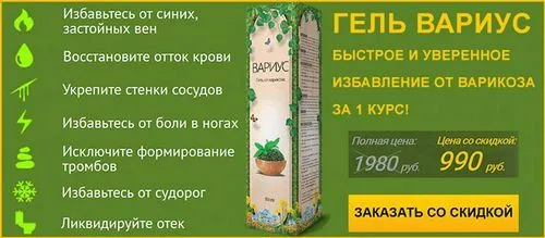 як лікувати варикоз у чоловіків