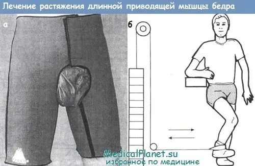 профілактика розтягування довгою привідного м'яза стегна