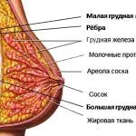 як лікувати фіброзну кісту
