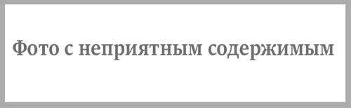 як лікувати себорею на тілі