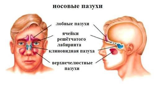 як лікувати кісту гайморової пазухи