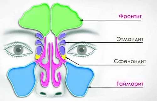 різниця