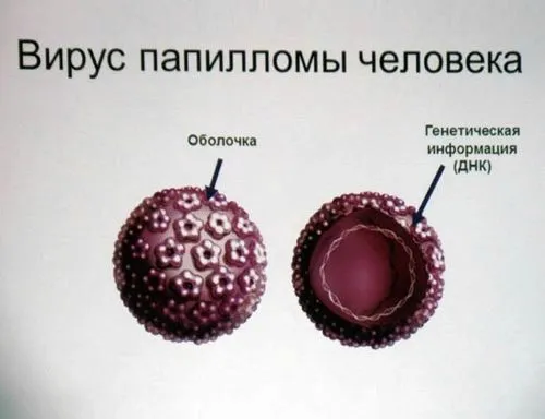 бородавки навколо заднього проходу