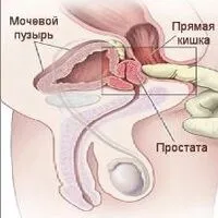 Мікоплазмоз і уреаплазмоз ніж лікувати уреаплазмоз мікоплазмоз