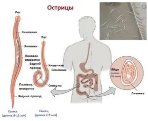 як лікувати глисти гострики
