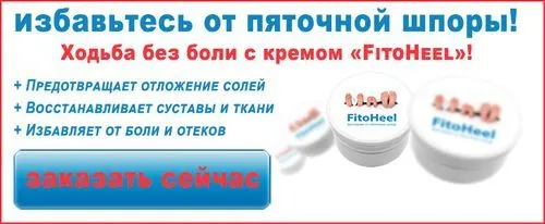 як вилікувати ноги від шпор