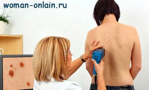 як вилікувати папіломи на тілі