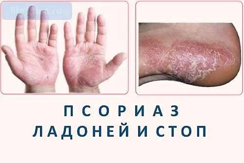 дерматолог