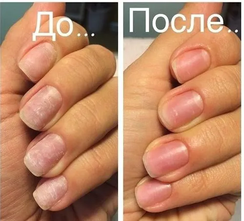 відновити нігті