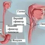 як лікувати внутрішній варикоз