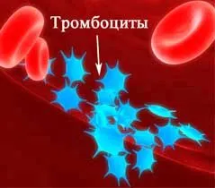 як лікувати варикоз матки при вагітності