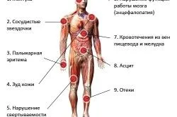 як лікувати гепатоз печінки народними засобами