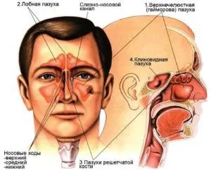 хронічний гнійний гайморит симптоми